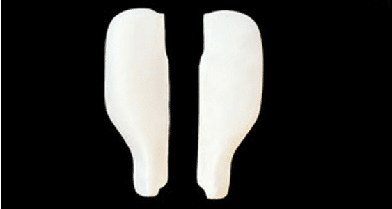 Recaro Wangensatz